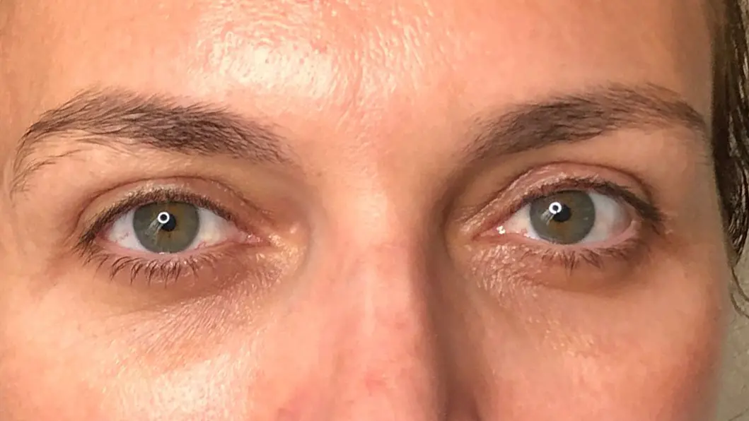 rehaussement de cils-browlift-avant-Bandol